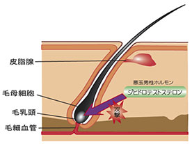 ジヒドロテストステロンを抑制