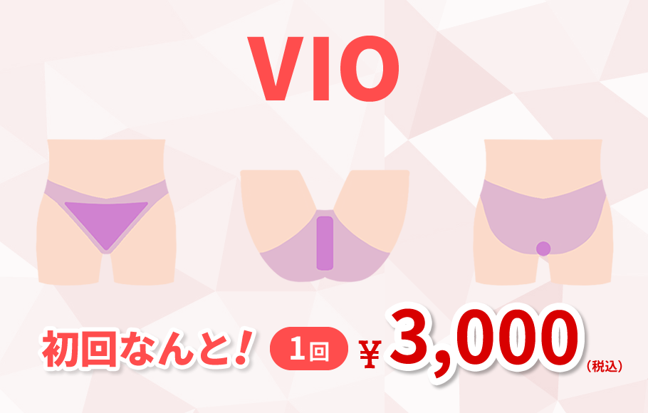 VIOレディース料金画像